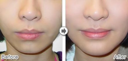 沈陽星美北順城醫(yī)療美容診所怎么樣？沈陽星美北順城醫(yī)療美容診所簡介|醫(yī)生團(tuán)隊|口碑評價！