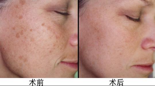 上海假體隆胸醫(yī)師推薦！王濤、亓發(fā)芝、劉天一帶您尋找完美曲線！