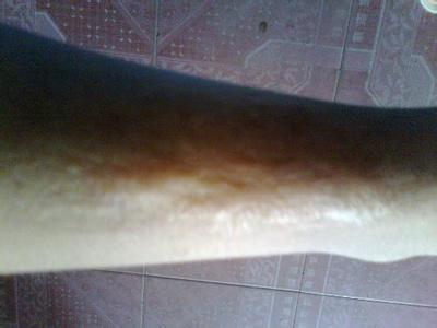 2023紹興耳軟骨隆鼻手術(shù)權(quán)威醫(yī)生榜單前十名(徐榮俊、方倫磊、謝劍入圍前四)