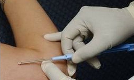 上海手術(shù)眼袋好的醫(yī)院有哪些？