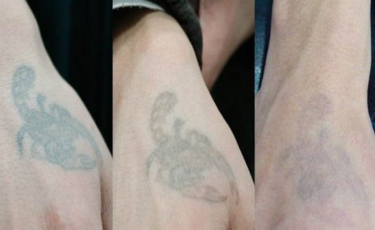 哈爾濱各具實(shí)力的隆鼻專家：宋楠、朱臺航、吳謙等斬獲排名！