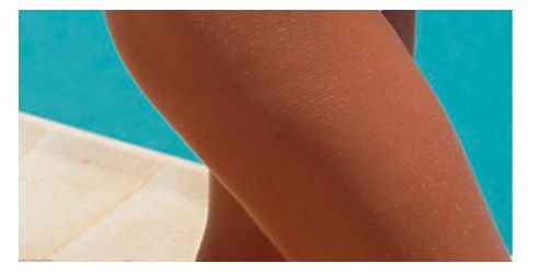 西安去雀斑醫(yī)院排名及用戶口碑評價，哪家醫(yī)院效果更好？