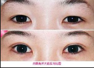 廊坊地區(qū)瘦臉針醫(yī)院排行榜2023：哪家醫(yī)院的瘦臉針效果好？