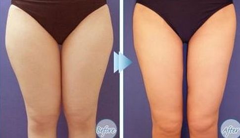 如何選擇最適合您的除腋臭治療醫(yī)院？全國哪家醫(yī)院好？