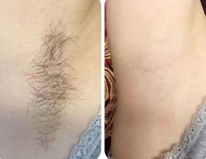 上海整形醫(yī)院哪家的好？最權威的排名榜單來幫你挑選！