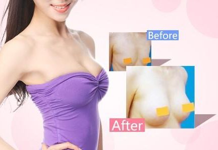 天津哪家醫(yī)院去疤痕好？專業(yè)醫(yī)生推薦的天津去疤痕頂級醫(yī)院有哪些？