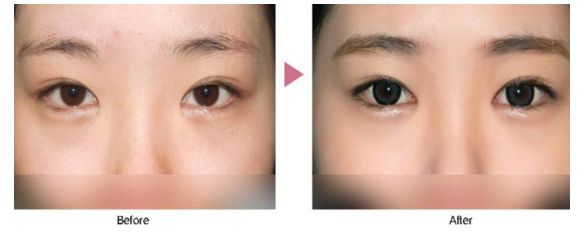 珠海整形醫(yī)院去哪家好？挑選術前評價好的整形醫(yī)院，放心修復您的美麗