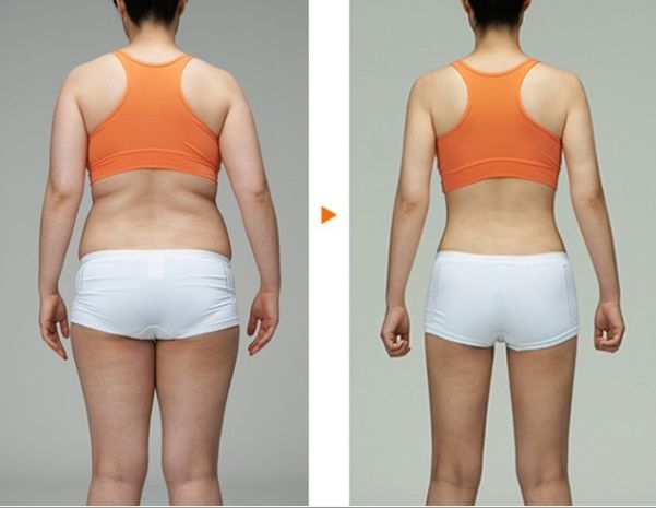 南京吸脂瘦臉哪家醫(yī)院好？全面解析南京吸脂手術(shù)的醫(yī)院排名及選擇攻略