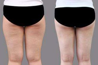 菏澤市整形醫(yī)院哪家好？排名榜單發(fā)布