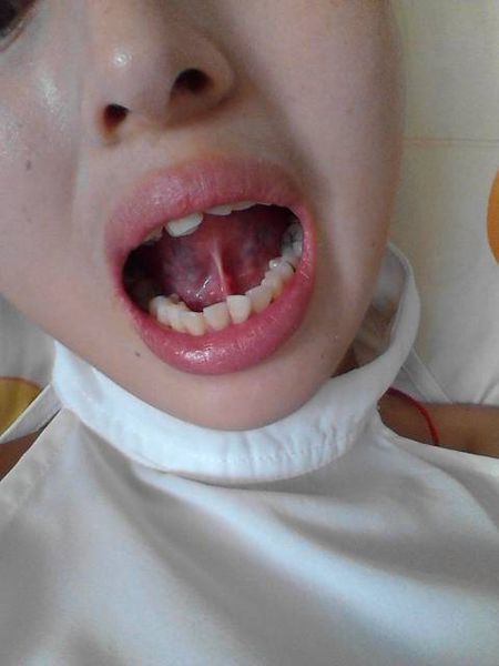 2023寧波botox除皺針權(quán)威專家排行前10強(qiáng)(茅來(lái)發(fā)、龔全康、田柏怡技術(shù)特色分享！)