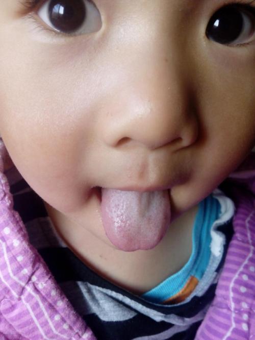 2023深圳光纖溶脂減腰部專家評(píng)價(jià)前10位(湯月碧、賈月、李英榜三強(qiáng)竟被他們拿下！)