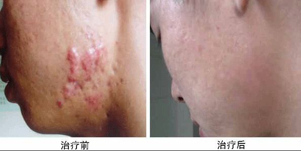 南京哪家醫(yī)院做兔唇手術效果好又安全？