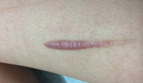 湘潭市美容哪家醫(yī)院好？探尋專家推薦，找到適合你的醫(yī)美機構(gòu)！