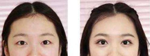 長沙整形科醫(yī)院排名及綜合評價：長沙哪家整形醫(yī)院口碑好？