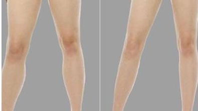 南京埋線醫(yī)院哪家好？權(quán)威專家推薦五家頂級(jí)醫(yī)院！