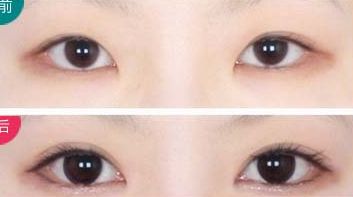 西安治療瘢痕哪家醫(yī)院好評不斷！