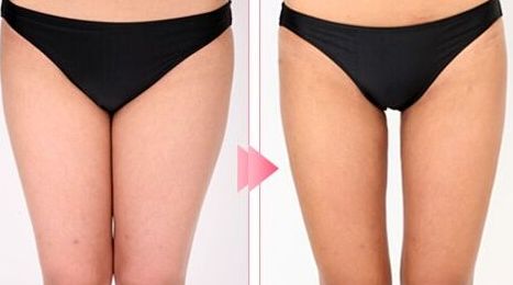 廊坊去斑的醫(yī)院哪家好？推薦您去哪家專業(yè)的醫(yī)院進(jìn)行去斑治療