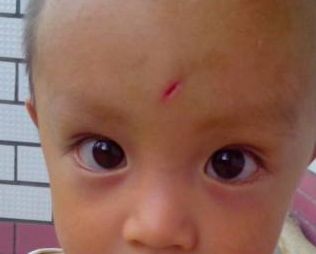 青島童顏線雕提升哪家好？選擇最佳青島童顏線雕醫(yī)院的3個關鍵因素