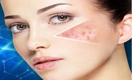 南京哪家醫(yī)院做埋線雙眼皮效果好？