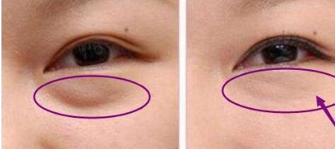 東莞豐胸醫(yī)生名單推薦！權(quán)威醫(yī)師梁如光、鄭志敏等值得信賴