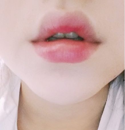 重慶去手術(shù)傷疤哪家醫(yī)院好？探尋重慶專業(yè)治療手術(shù)疤痕的醫(yī)院排名