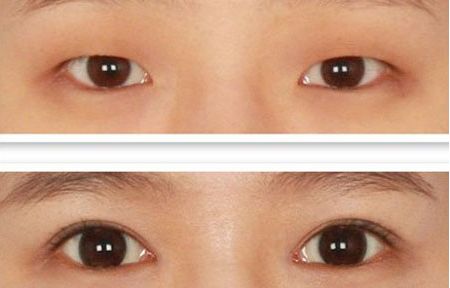 北京整容科好的醫(yī)院有哪些？中關(guān)村整形醫(yī)院綜合實力領(lǐng)先！