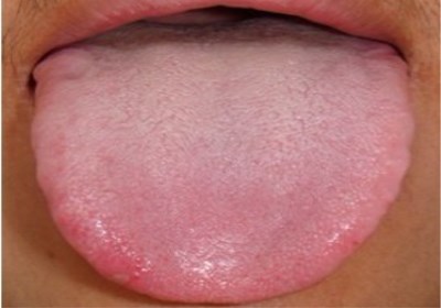 2023淮安鼻子綜合整形權(quán)威專家評(píng)價(jià)前10位(趙步祥、房進(jìn)、熊猛老用戶強(qiáng)力安利)