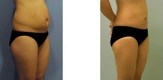 濟(jì)南哪家醫(yī)院做雙眼皮效果好？