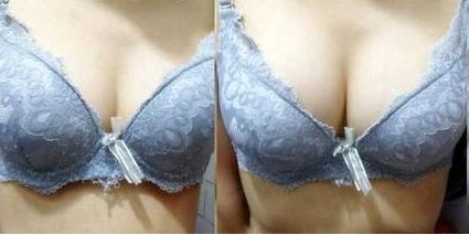 上饒雙眼皮手術(shù)哪家醫(yī)院好？專業(yè)排名推薦！