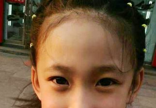 蘇州激光祛疤哪家醫(yī)院好？選擇激光祛疤專家，恢復美肌無憂！