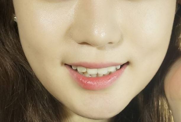 廣州集美醫(yī)療美容怎么樣？廣州集美醫(yī)療美容簡(jiǎn)介|醫(yī)生團(tuán)隊(duì)|口碑評(píng)價(jià)！