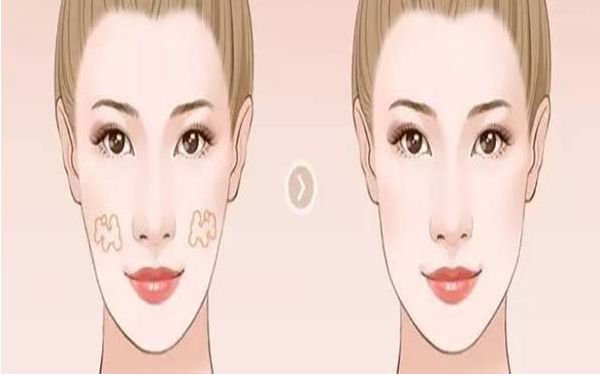 上海雙眼皮埋線醫(yī)院排名及專家推薦：哪家醫(yī)院最好？