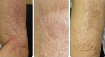 【2023廈門】專業(yè)廈門埋線減肥醫(yī)院哪家口碑好？