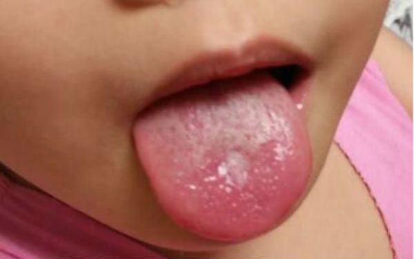 2023南昌祛除口周紋手術(shù)強(qiáng)榜前10的醫(yī)生(李焱麗、李丹、徐愛兵口碑技術(shù)并存)