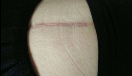 杭州市哪家醫(yī)院的玻尿酸注射技術(shù)更好？附醫(yī)生資料及整形科點(diǎn)評