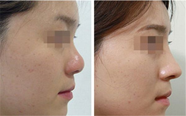 珠海市醫(yī)療美容醫(yī)院哪家好？解析當今最受歡迎的珠海醫(yī)療美容機構(gòu)