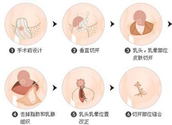 保定的整形醫(yī)院哪家好？全面解析保定整形醫(yī)院排名、口碑、專(zhuān)業(yè)團(tuán)隊(duì)等