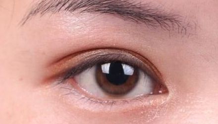 蘇州雙眼皮修復(fù)醫(yī)院排名及口碑，哪家醫(yī)院修復(fù)效果最好？