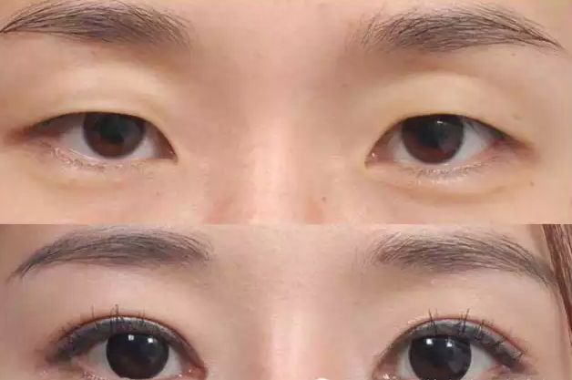 2023常德光纖溶脂減手臂在榜名單top10強(qiáng)專(zhuān)家(陳貴南、梁亮、李元全熱門(mén)口碑專(zhuān)家集中匯總！)