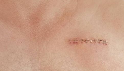 南昌市整形醫(yī)院哪家好？完全解析南昌市整形醫(yī)院的專業(yè)技術(shù)和服務(wù)