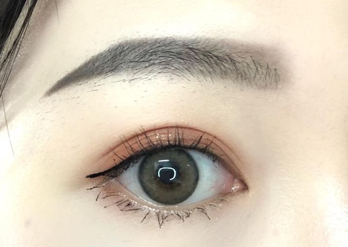 承德哪家整形醫(yī)院做雙眼皮效果好，選擇哪家醫(yī)院做雙眼皮效果最好