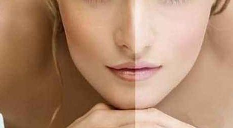 昆明整形哪家好卓星贊揚？解讀昆明整形行業(yè)卓星贊揚