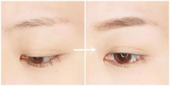 2023福州干細胞美雕祛斑權(quán)威專家榜單前10位(趙棟材、王波、任文明均是高人氣網(wǎng)紅醫(yī)生)