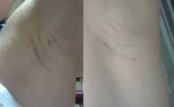 恩施地區(qū)有哪些信譽好的美容整形醫(yī)院？