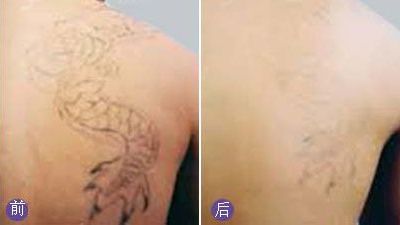 無錫哪家醫(yī)院眼科專業(yè)好？