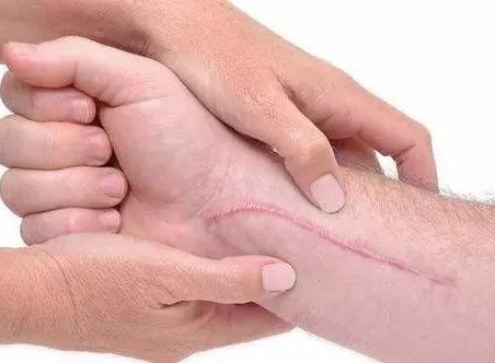 昆明雙眼皮修復(fù)，哪家醫(yī)院專業(yè)且可靠？