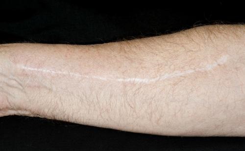 2023樂山鼻部矯正強(qiáng)榜前10名的醫(yī)生(李凌云、賴運(yùn)泰、岑曉勇實力強(qiáng))