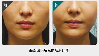 錦州整形美容醫(yī)院哪家靠譜？醫(yī)療技術(shù)如何？