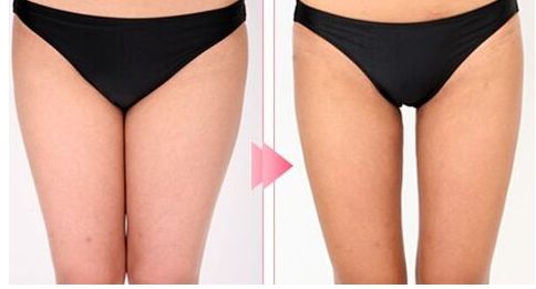 昆明哪家醫(yī)院做拉皮手術(shù)好？體驗分享+專家推薦，盡在本文！