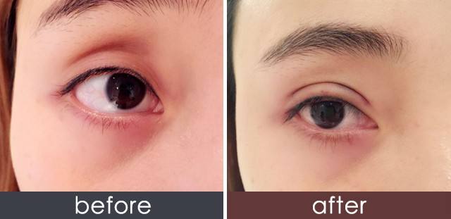 2023呼倫貝爾瑞藍除皺正規(guī)醫(yī)生評價TOP10(鄒毓超、裴寧、李乃東實力領銜榜首)